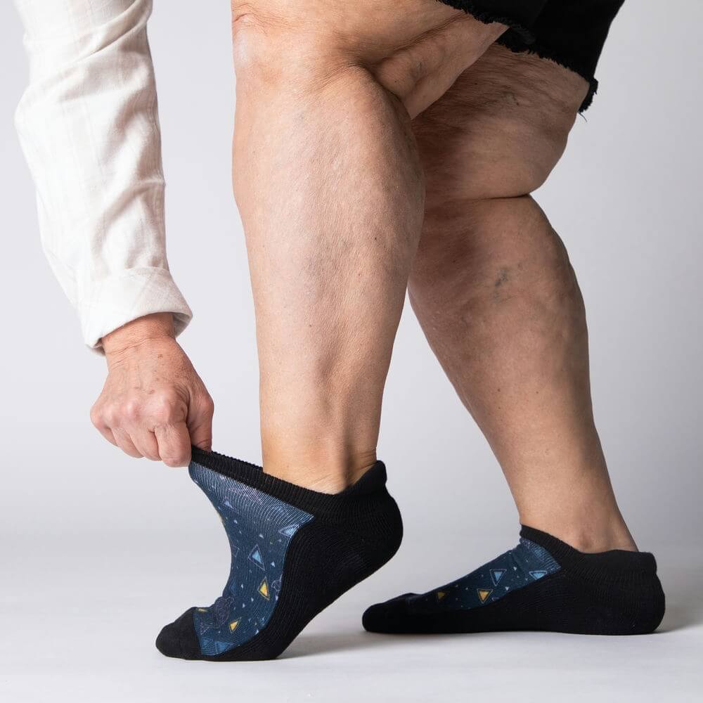 Orcas Ankle Socks - Image 3